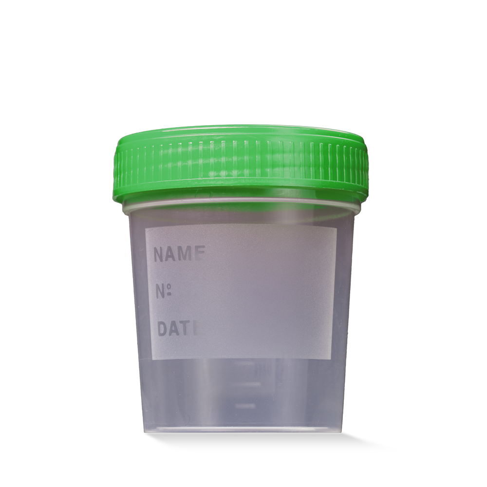 PP Urinsammelbehälter mit Schraubdeckel, 100 ml graduiert, Farbe transparent, milchig, grün